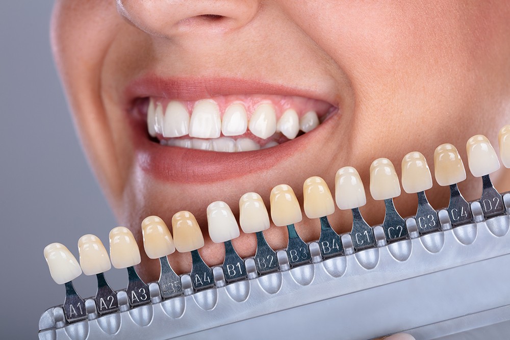 What Are Different Types of Dental Implants