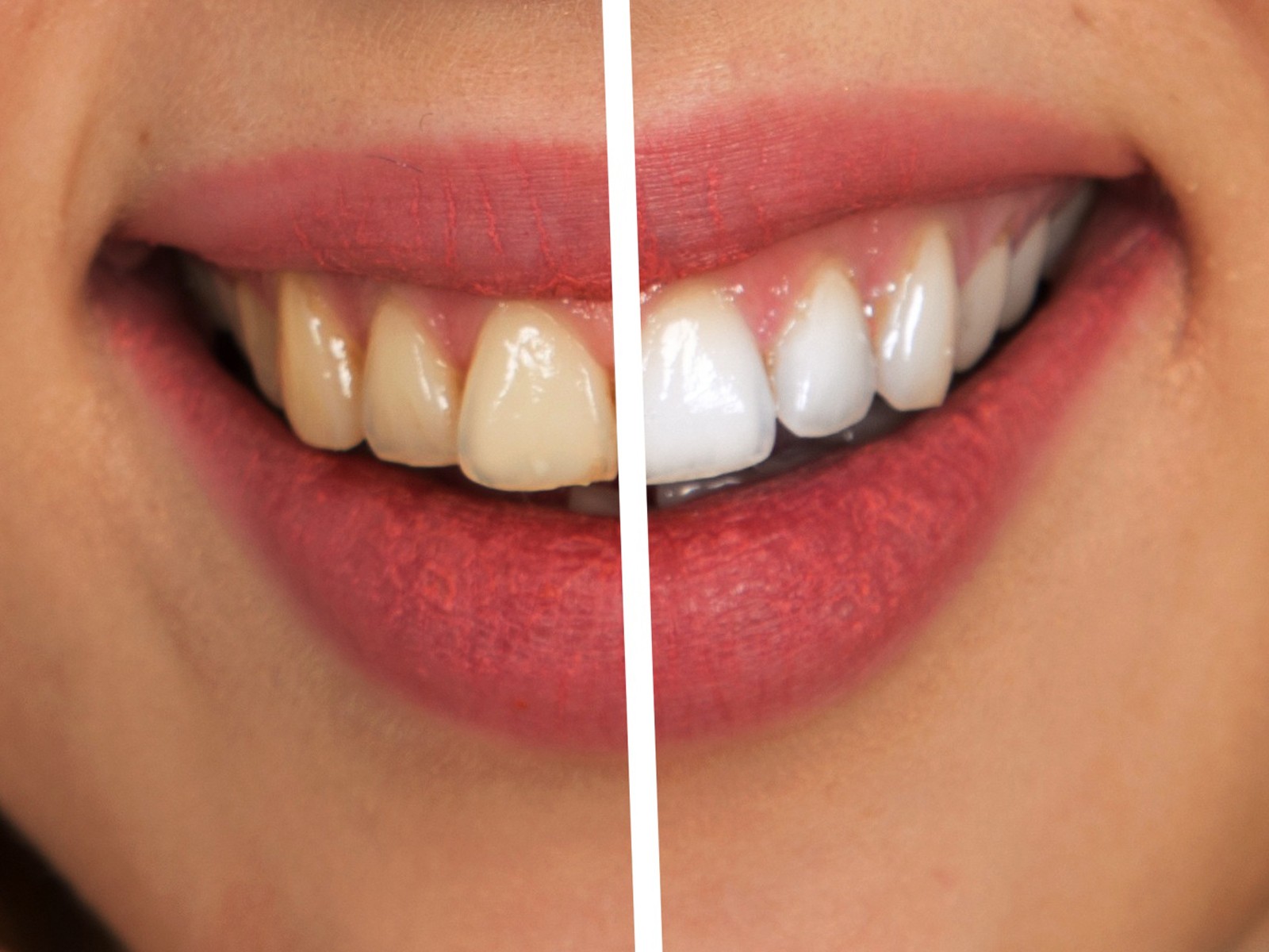 What You Can Do About the Color of Your Teeth?