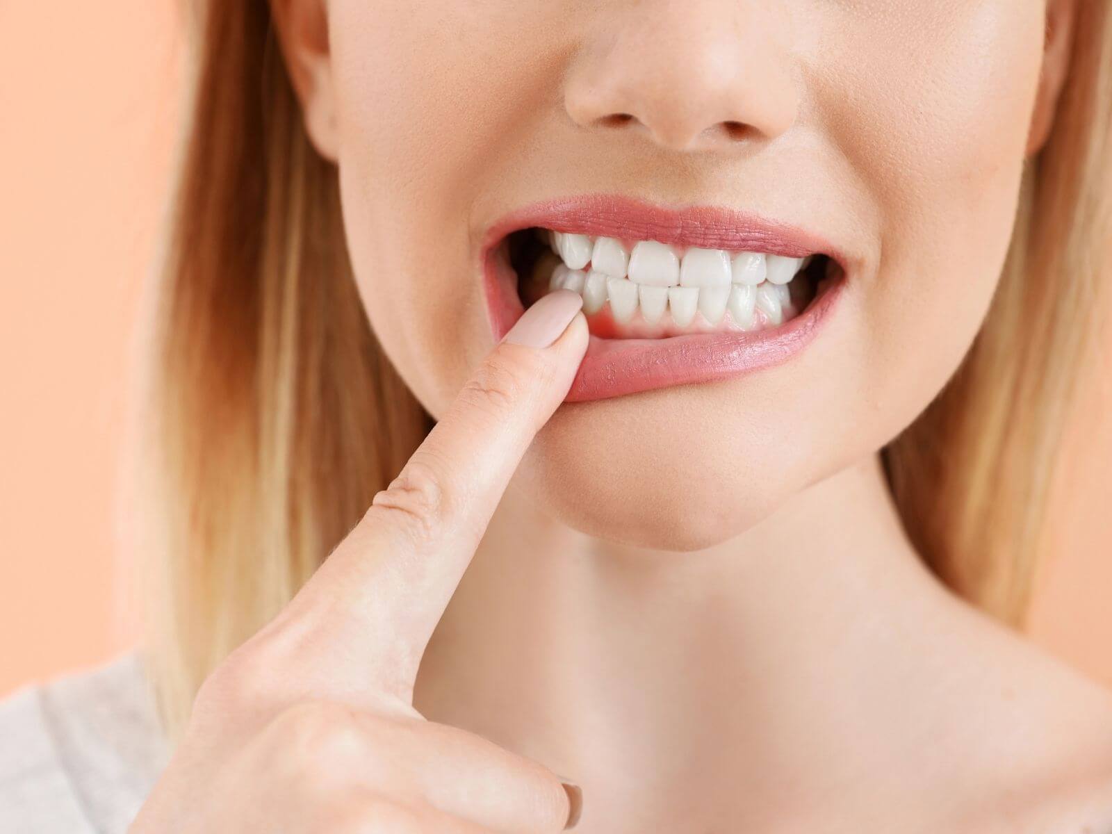 5 Simple Tips To Prevent Gum Disease At Home
