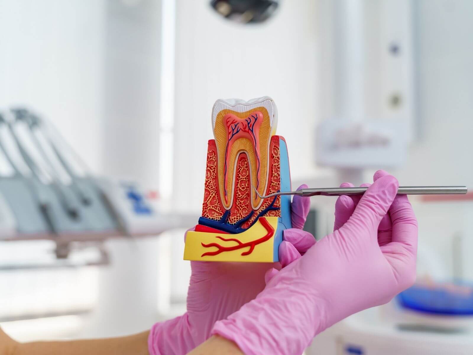 Do Root Canals Hurt? Pain, Recovery, and What to Expect