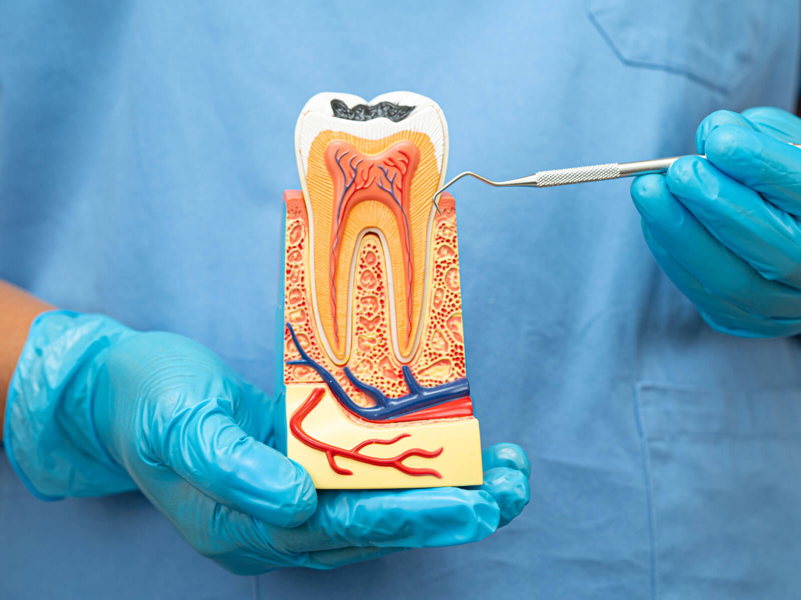 Top Myths About Root Canals Debunked: Pain, Illness Claims, and Extraction Comparisons